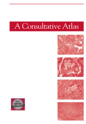 Lung Pathology: A Consultative Atlas