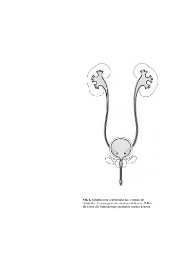 Praxis der Urinzytologie: Phasenkontrastmikroskopie und Analyse gefärbter Präparate