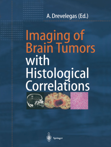 Imaging of Brain Tumors with Histological Correlations