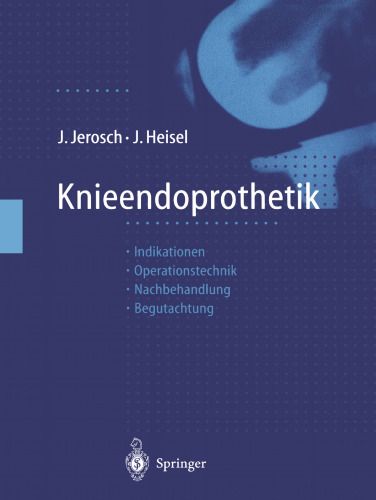 Knieendoprothetik: Indikationen · Operationstechnik Nachbehandlung · Begutachtung