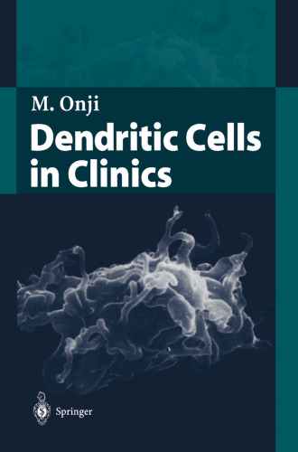 Dendritic Cells in Clinics