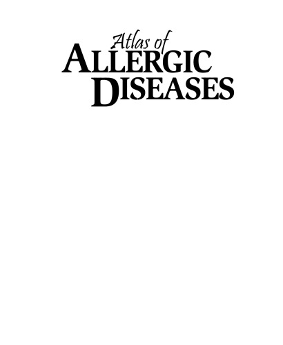 Atlas of Allergic Diseases