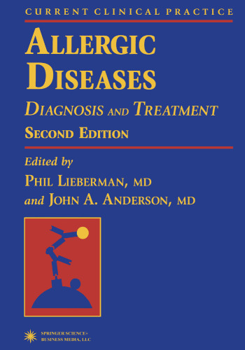 Allergic Diseases: Diagnosis and Treatment