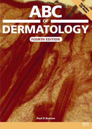 ABC of Dermatology with CD-ROM