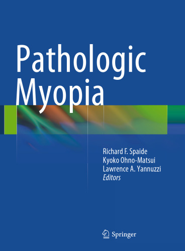 Pathologic Myopia