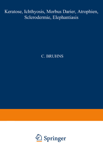 Keratosen · Ichthyosis Morbus Darier · Atrophien Sclerodermie·Elephantiasis