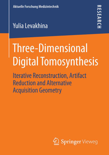 Three-Dimensional Digital Tomosynthesis: Iterative Reconstruction, Artifact Reduction and Alternative Acquisition Geometry