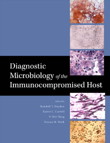 Diagnostic microbiology of the immunocompromised host