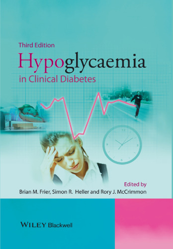 Hypoglycaemia in clinical diabetes