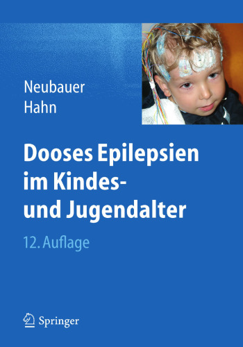 Dooses Epilepsien im Kindes- und Jugendalter