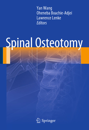 Spinal Osteotomy