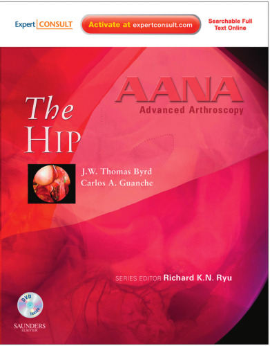 AANA Advanced Arthroscopy. The Hip