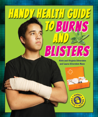 Handy Health Guide to Burns and Blisters