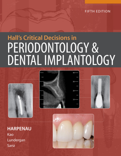 Hall's Critical Decisions in Periodontology