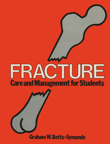 Fracture: Care and Management for Students