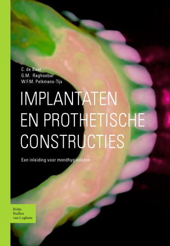 Implantaten en prothetische constructies: Een inleiding voor mondhygiënisten