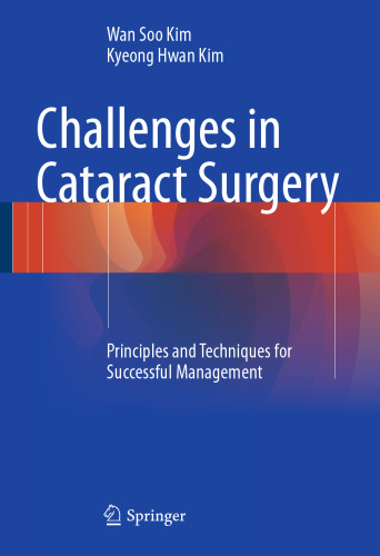 Challenges in Cataract Surgery: Principles and Techniques for Successful Management