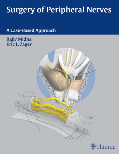 Surgery of peripheral nerves