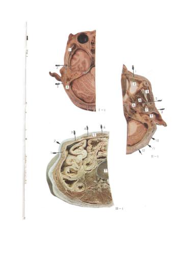 Atlas of Cross Sectional Anatomy of Human 14 Meridians and Acupoints