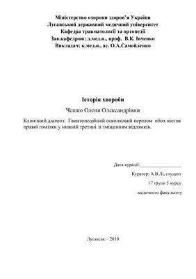 Гвинтоподібний осколковий перелом обох кісток правої гомілки у нижній третині зі зміщенням відламків