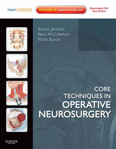 Core Techniques in Operative Neurosurgery V.1