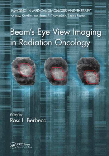 Beam’s Eye View Imaging in Radiation Oncology