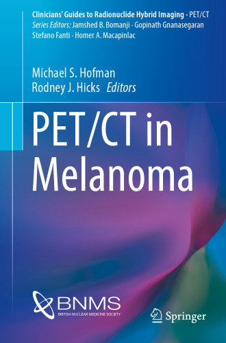 PET/CT in melanoma