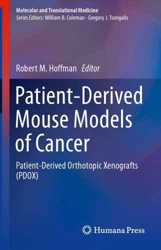 Patient-Derived Mouse Models of Cancer : Patient-Derived Orthotopic Xenografts (PDOX)