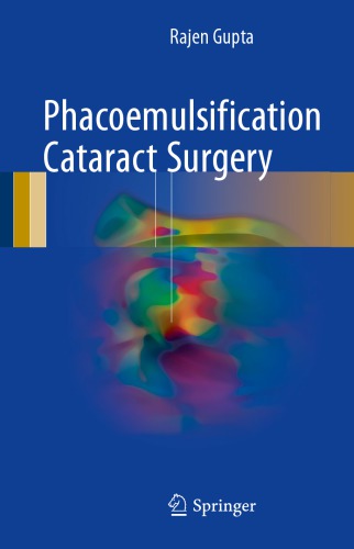 Phacoemulsification cataract surgery