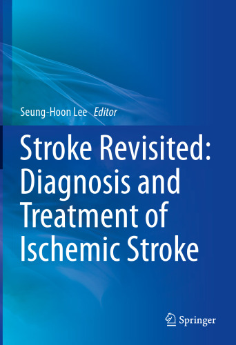 Stroke revisited : diagnosis and treatment of ischemic stroke