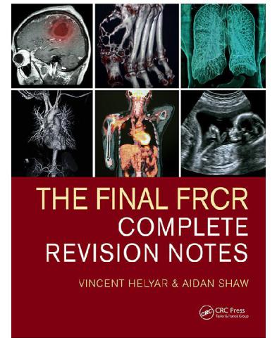 The Final FRCR : Complete Revision Notes