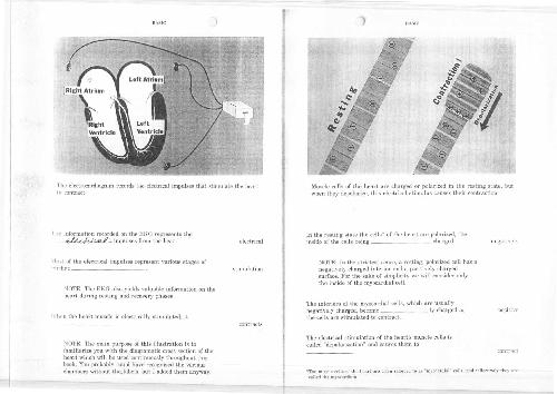 Rapid Interpretation of EKG's