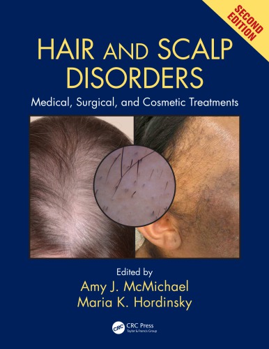 Pocketbook of Hair and Scalp Disorders