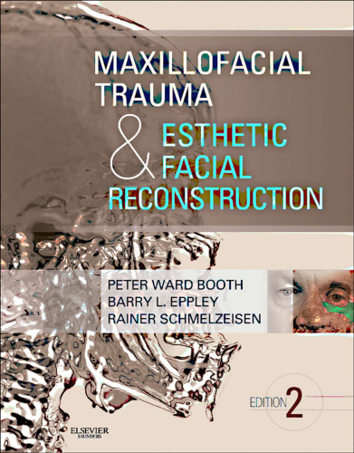 Maxillofacial trauma & esthetic facial reconstruction