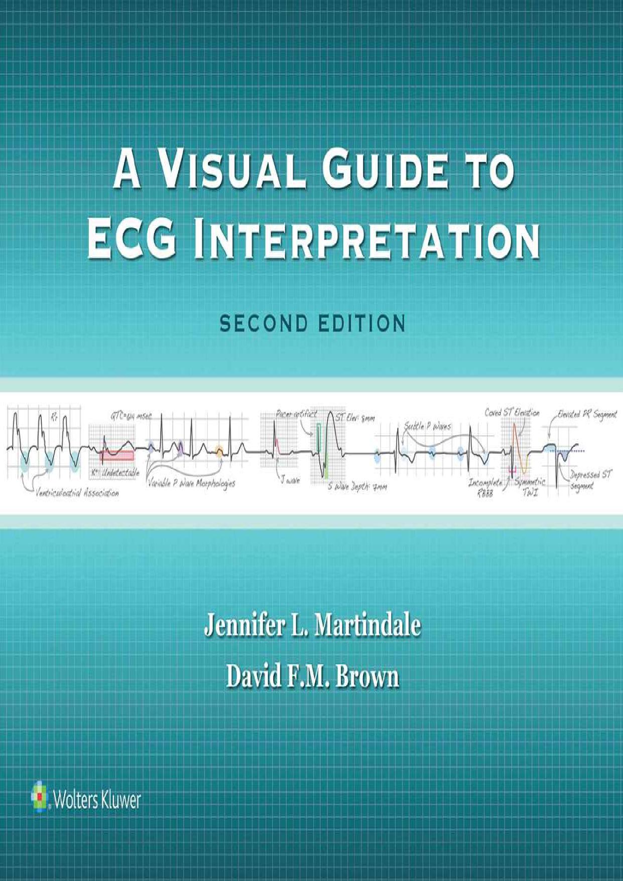 A Visual Guide to ECG Interpretation