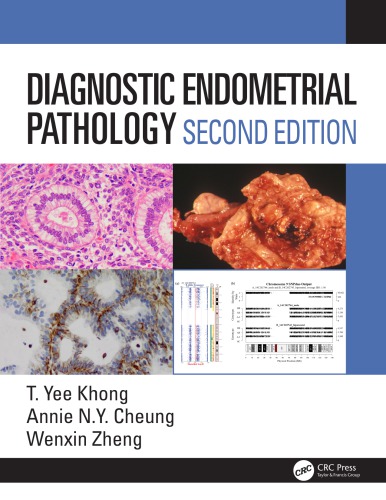 Diagnostic endometrial pathology