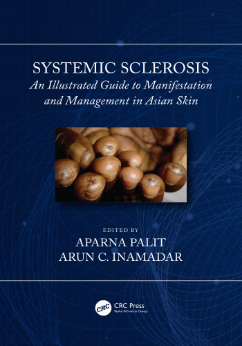 Systemic sclerosis: an illustrated guide to manifestation and management in Asian skin