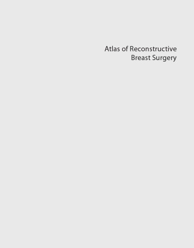 Atlas of Reconstructive Breast Surgery