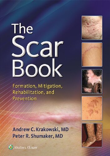 The Scar Book: Formation, Mitigation, Rehabilitation and Prevention