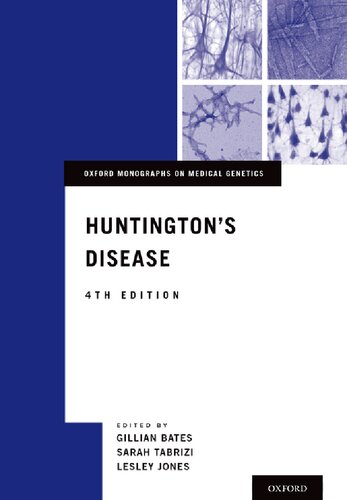 Huntington's disease