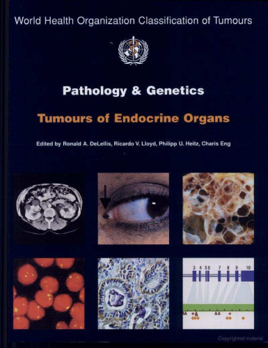 Pathology and Genetics of Tumours of Endocrine Organs