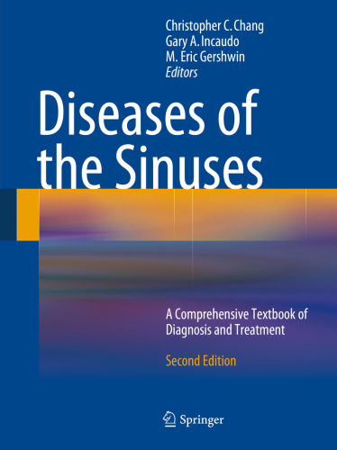 Diseases of the Sinuses A Comprehensive Textbook of Diagnosis and Treatment