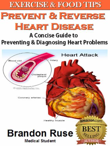 How To Prevent Heart Disease: A Concise Guide to Preventing & Diagnosing Heart Problems