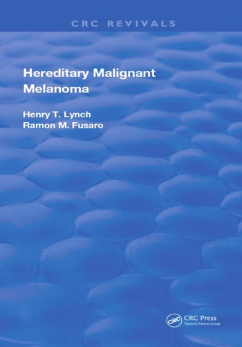 Hereditary Malignant Melanoma