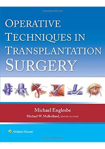 Transplantation Surgery