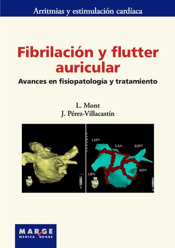 Fibrilacion Y Flutter Auricular