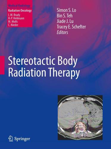 Stereotactic Body Radiation Therapy