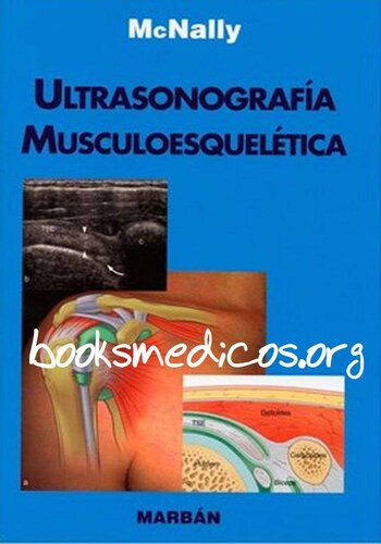 Ultrasonografia Musculoesqueletica