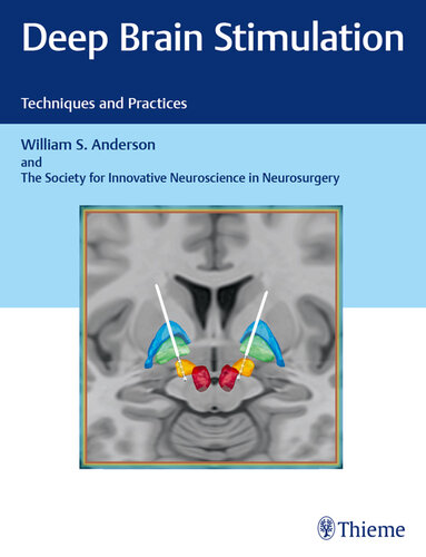 Deep Brain Stimulation: Techniques and Practices