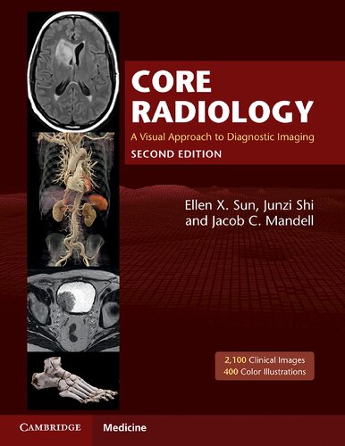 Core radiology : a visual approach to diagnostic imaging.